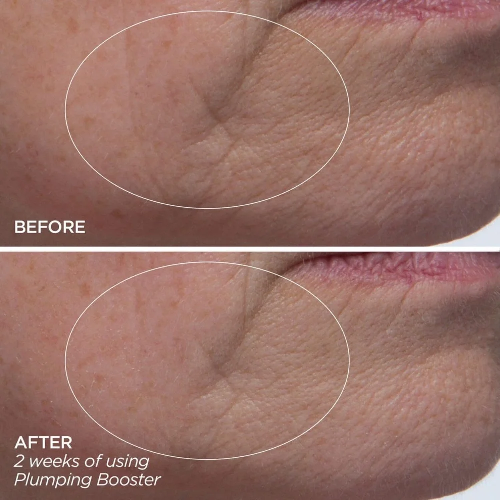BeautyBio - Plumping Booster | Hyaluronic Acid Line-Filling & Plumping Treatment